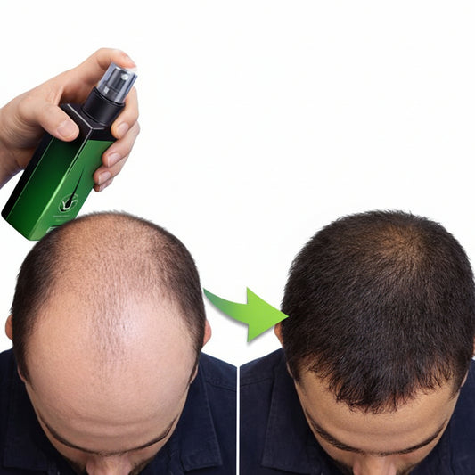 بخاخ الزنجبيل لنمو الشعر